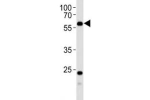 Image no. 3 for anti-6-phosphofructo-2-Kinase/fructose-2,6-Biphosphatase 3 (PFKFB3) (AA 454-484) antibody (ABIN3029823)
