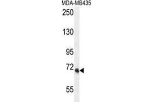 Image no. 2 for anti-Vacuolar Protein Sorting 52 Homolog (VPS52) (AA 613-641), (C-Term) antibody (ABIN955527)