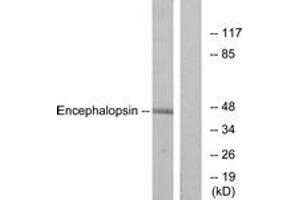 Image no. 2 for anti-Opsin 3 (OPN3) (AA 161-210) antibody (ABIN1535598)
