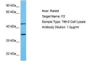 Image no. 4 for anti-Coagulation Factor II (thrombin) (F2) (Middle Region) antibody (ABIN2776976)