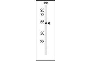 Image no. 1 for anti-Keratin 78 (KRT78) (AA 182-212), (Middle Region) antibody (ABIN952980)