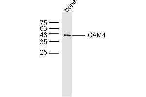 Image no. 3 for anti-Intercellular Adhesion Molecule 4 (ICAM4) (AA 85-180) antibody (ABIN873300)