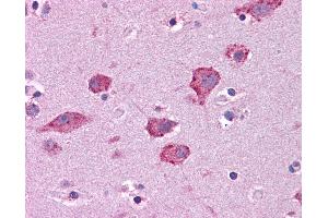Image no. 1 for anti-Hepatocyte Growth Factor (Hepapoietin A, Scatter Factor) (HGF) (AA 216-265) antibody (ABIN604744)