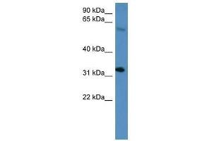 Image no. 1 for anti-Homeobox D13 (HOXD13) (C-Term) antibody (ABIN927346)