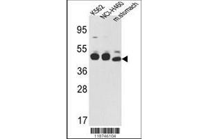 Image no. 2 for anti-Keratin 18 (KRT18) (AA 401-430), (C-Term) antibody (ABIN391561)