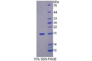 Image no. 1 for Fatty Acid Binding Protein 6, Ileal (FABP6) (AA 1-128) protein (His tag) (ABIN6239149)
