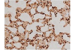 Image no. 5 for anti-Ezrin (EZR) (pTyr353) antibody (ABIN6256714)