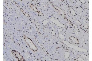 Image no. 4 for anti-Jun B Proto-Oncogene (JUNB) (pThr255) antibody (ABIN6269895)