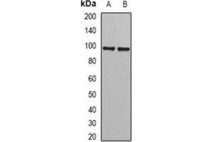 Image no. 2 for anti-PHD Finger Protein 17 (PHF17) antibody (ABIN2966898)