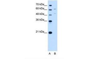 Image no. 1 for anti-UDP Glucuronosyltransferase 1 Family, Polypeptide A4 (UGT1A4) (AA 59-108) antibody (ABIN6749736)