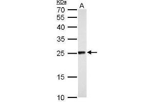 Image no. 1 for anti-NADH Dehydrogenase (Ubiquinone) Flavoprotein 2, 24kDa (NDUFV2) (Center) antibody (ABIN2855340)