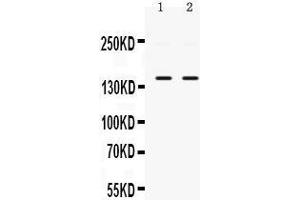 PPP1R12A antibody  (N-Term)