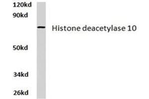Image no. 2 for anti-Histone Deacetylase 10 (HDAC10) antibody (ABIN265454)