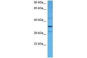 Image no. 4 for anti-NF-kappa-B inhibitor beta (NFKBIB) (N-Term) antibody (ABIN2775762)