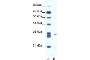 Image no. 1 for anti-E3 Ubiquitin-Protein Ligase SIAH1 (SIAH1) (N-Term) antibody (ABIN2778297)