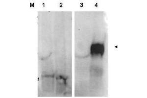 Image no. 2 for anti-Fibroblast Activation Protein, alpha (FAP) (Internal Region) antibody (ABIN349584)