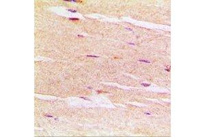 Image no. 1 for anti-Sarcoglycan, delta (35kDa Dystrophin-Associated Glycoprotein) (SGCD) antibody (ABIN3198032)