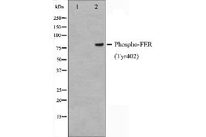 Image no. 2 for anti-FER Tyrosine Kinase (FER) (pTyr402) antibody (ABIN6255906)
