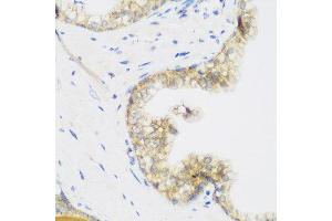 Image no. 4 for anti-KIAA1456 (KIAA1456) antibody (ABIN2563549)