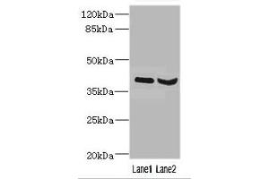 HOXD1 antibody  (AA 1-240)