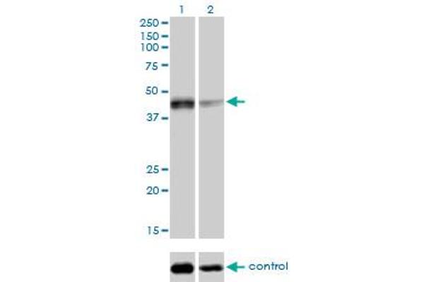 anti-Sirtuin 2 (SIRT2) (AA 128-227) antibody