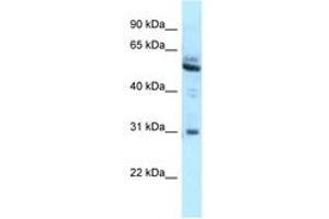 Image no. 1 for anti-Lymphoid-Restricted Membrane Protein (LRMP) (AA 354-403) antibody (ABIN6747836)