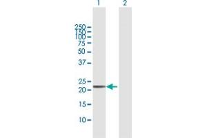 anti-Thioredoxin Domain Containing 9 (TXNDC9) (AA 1-188) antibody