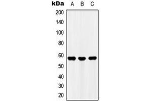 Image no. 1 for anti-Ubiquitin Family Domain Containing 1 (UBFD1) (C-Term) antibody (ABIN2705322)