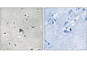 Image no. 2 for anti-Claudin 4 (CLDN4) (AA 160-209) antibody (ABIN1533162)