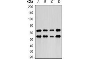 Image no. 3 for anti-PDZ and LIM Domain 5 (PDLIM5) antibody (ABIN3198186)
