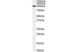 Image no. 3 for anti-ADAM Metallopeptidase Domain 17 (ADAM17) (C-Term) antibody (ABIN184721)