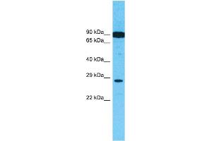 Image no. 4 for anti-Hepatocyte Growth Factor (Hepapoietin A, Scatter Factor) (HGF) (N-Term) antibody (ABIN2781816)