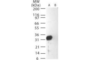 Image no. 1 for anti-SARS-Coronavirus Membrane Protein (SARS-CoV M) (AA 195-210) antibody (ABIN199995)