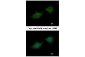 ICC/IF Image Immunofluorescence analysis of methanol-fixed HeLa, using MMP3, antibody at 1:200 dilution.