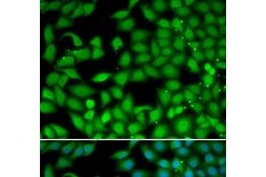 Immunofluorescence analysis of MCF-7 cells using RTKN Polyclonal Antibody
