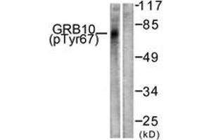 Western blot analysis of extracts from NIH-3T3 cells treated with Insulin 0.