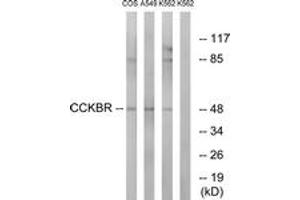 Image no. 1 for anti-Cholecystokinin B Receptor (CCKBR) (AA 11-60) antibody (ABIN1535578)