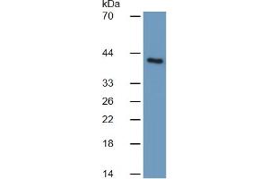 Mouse Capture antibody from the kit in WB with Positive Control:  Rat Liver lysate.