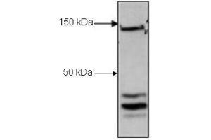 Image no. 1 for anti-CCCTC-Binding Factor (Zinc Finger Protein) (CTCF) (C-Term) antibody (ABIN964615)
