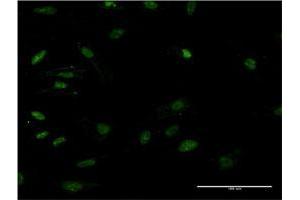 Image no. 5 for anti-High Mobility Group Box 2 (HMGB2) (AA 1-195) antibody (ABIN947976)