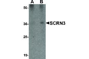 Secernin 3 Antikörper  (Internal Region)