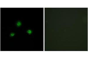 Immunofluorescence analysis of A549 cells, using Ubinuclein Antibody.