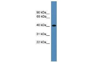 Image no. 1 for anti-Aminoacyl tRNA Synthetase Complex-Interacting Multifunctional Protein 2 (AIMP2) (Middle Region) antibody (ABIN929207)