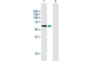Western Blot analysis of RPS6KB2 expression in transfected 293T cell line by RPS6KB2 MaxPab polyclonal antibody.