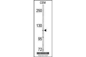 Western Blotting (WB) image for anti-tyrosine Kinase, Non-Receptor, 2 (TNK2) (C-Term) antibody (ABIN2158883)