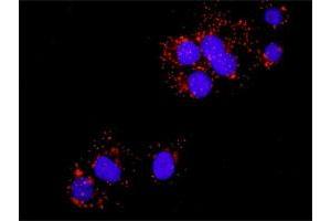Proximity Ligation Assay (PLA) image for FYN & CTNNB1 Protein Protein Interaction Antibody Pair (ABIN1339897)