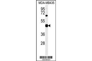 Image no. 1 for anti-SH2 Domain Protein 2A (SH2D2A) (AA 86-112) antibody (ABIN651523)