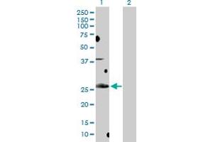 Image no. 1 for anti-B-Cell CLL/lymphoma 7B (BCL7B) (AA 1-202) antibody (ABIN522763)