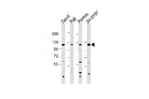 All lanes : Anti-LILRB1 Antibody (Center) at 1:500-1:2000 dilution Lane 1: Daudi whole cell lysate Lane 2: Raji whole cell lysate Lane 3: Ramos whole cell lysate Lane 4: SH-SY5Y whole cell lysate Lysates/proteins at 20 μg per lane.