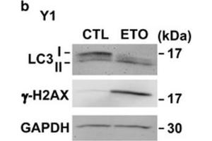 Image no. 94 for anti-Glyceraldehyde-3-Phosphate Dehydrogenase (GAPDH) (Center) antibody (ABIN2857072)